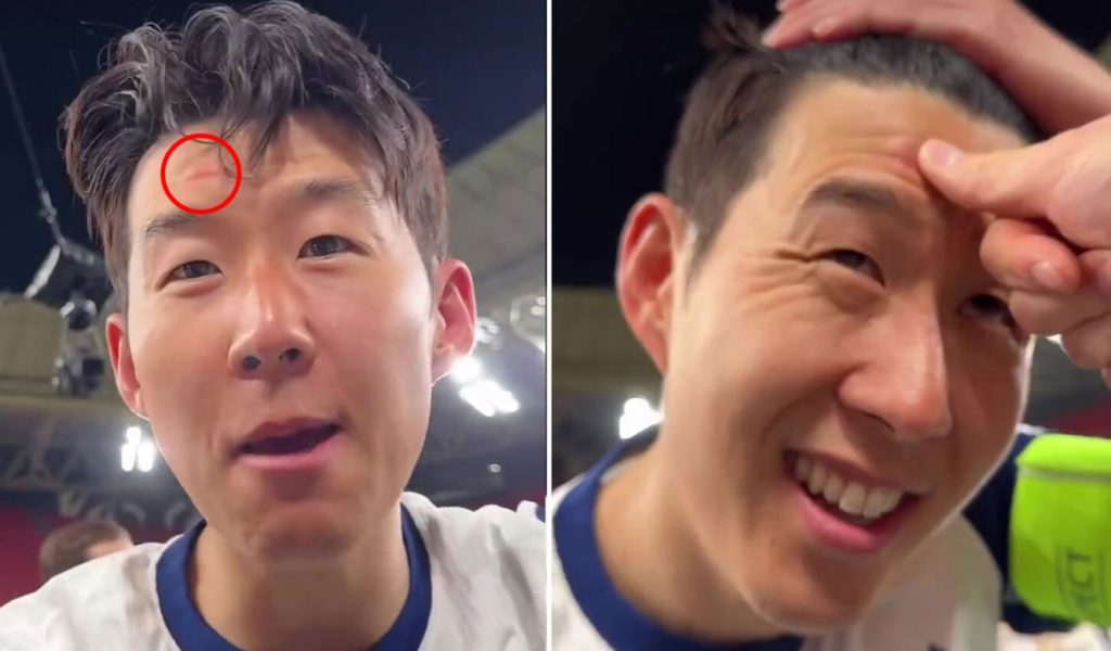 Son Heung-min gặp sự cố khi ăn mừng chức vô địch Europa League