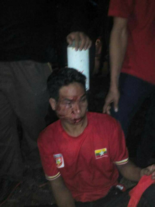 Tới Shah Alam coi đá bóng, CĐV U22 Myanmar bị đánh cho sấp mặt